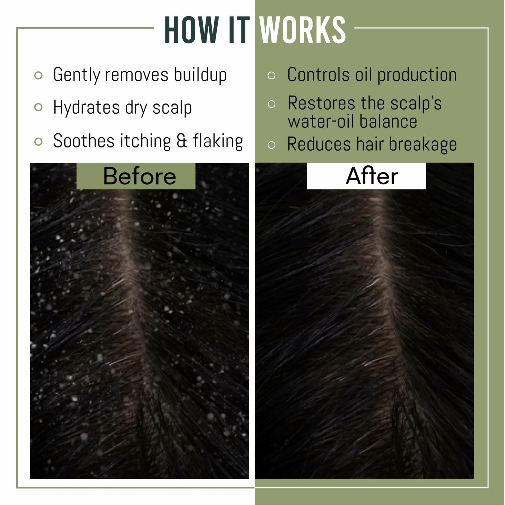 MagiForet Anti-Dandruff Shampoo & Conditioner Set 2x500ml Dry Flaky Scalp